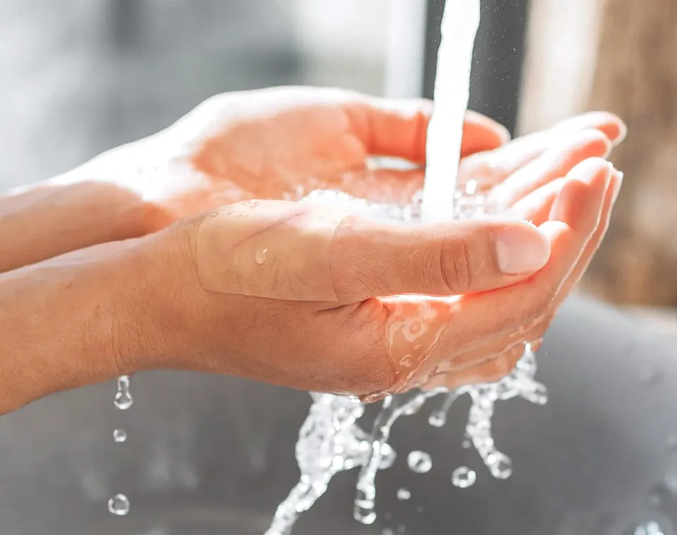 Hands under running water with a hydrocolloid patch in place