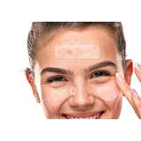 TKTK Large Pimple Patches, Hydrocolloid Strips in 5 Sizes, photo 4